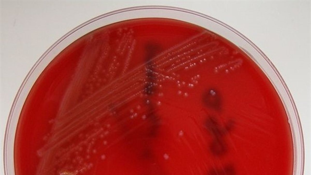 La carne con listeria se distribuyó también en Madrid y Extremadura pero ha sido retirada. /WIKIMEDIA COMMONS/NATHAN READING