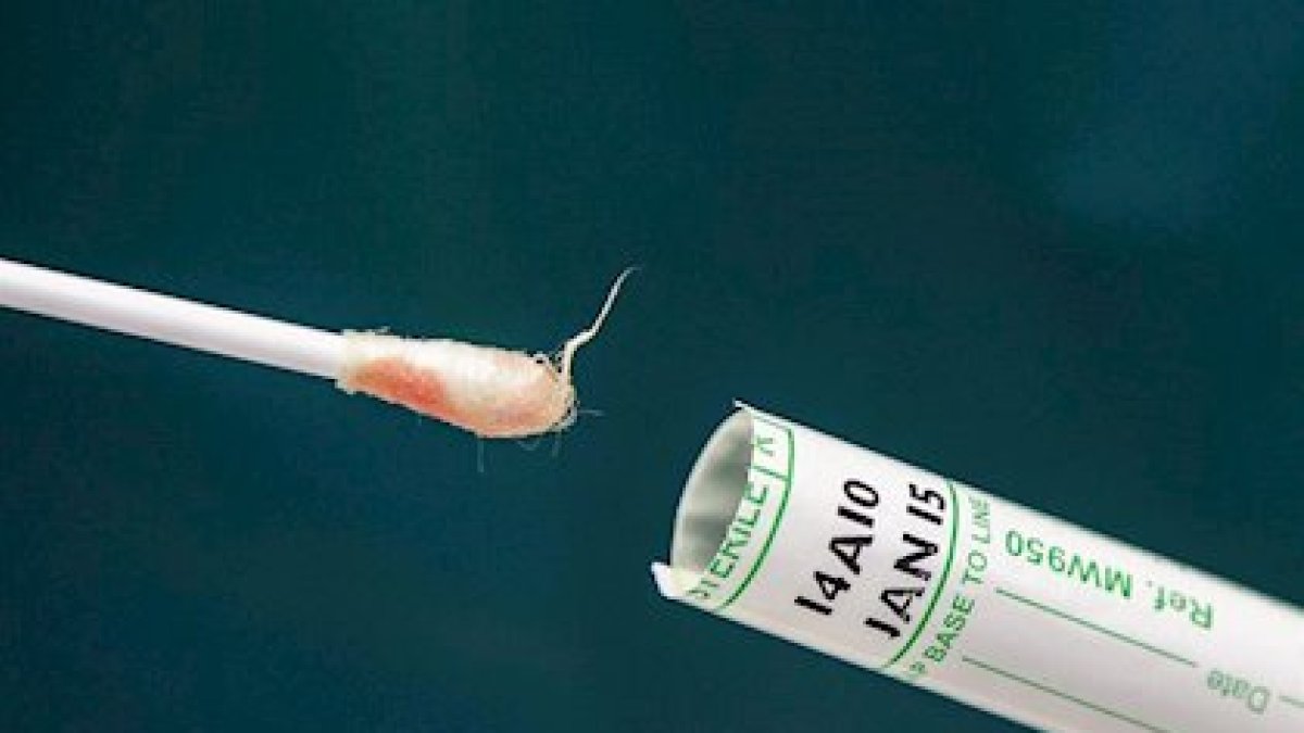 Imagen de archivo de una muestra de gripe común.