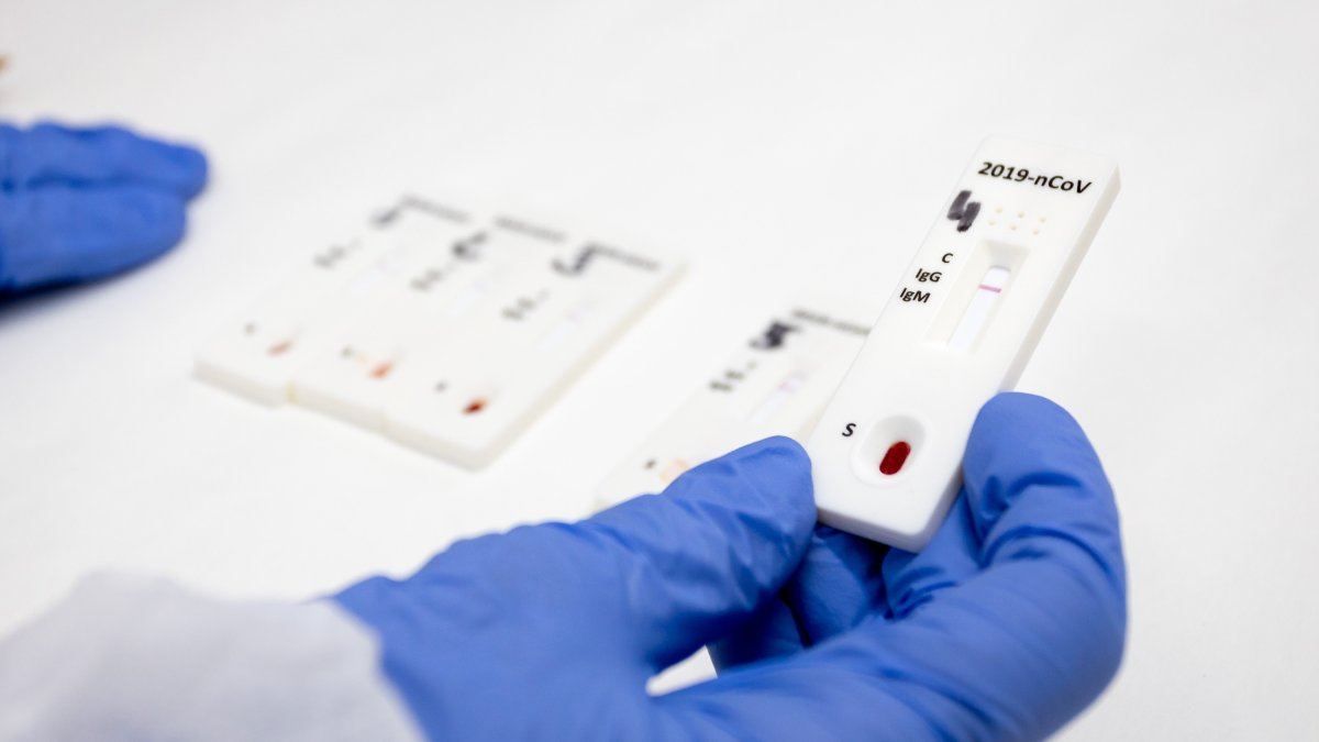 Sanidad incluye a servicios esenciales y personas vulnerables en el grupo al que recomienda realizar test