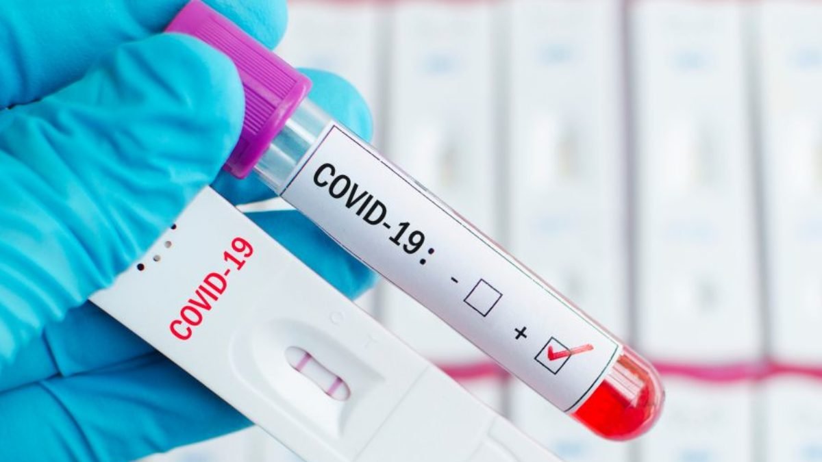 Los equipos de Primera y Segunda ya disponen de test.