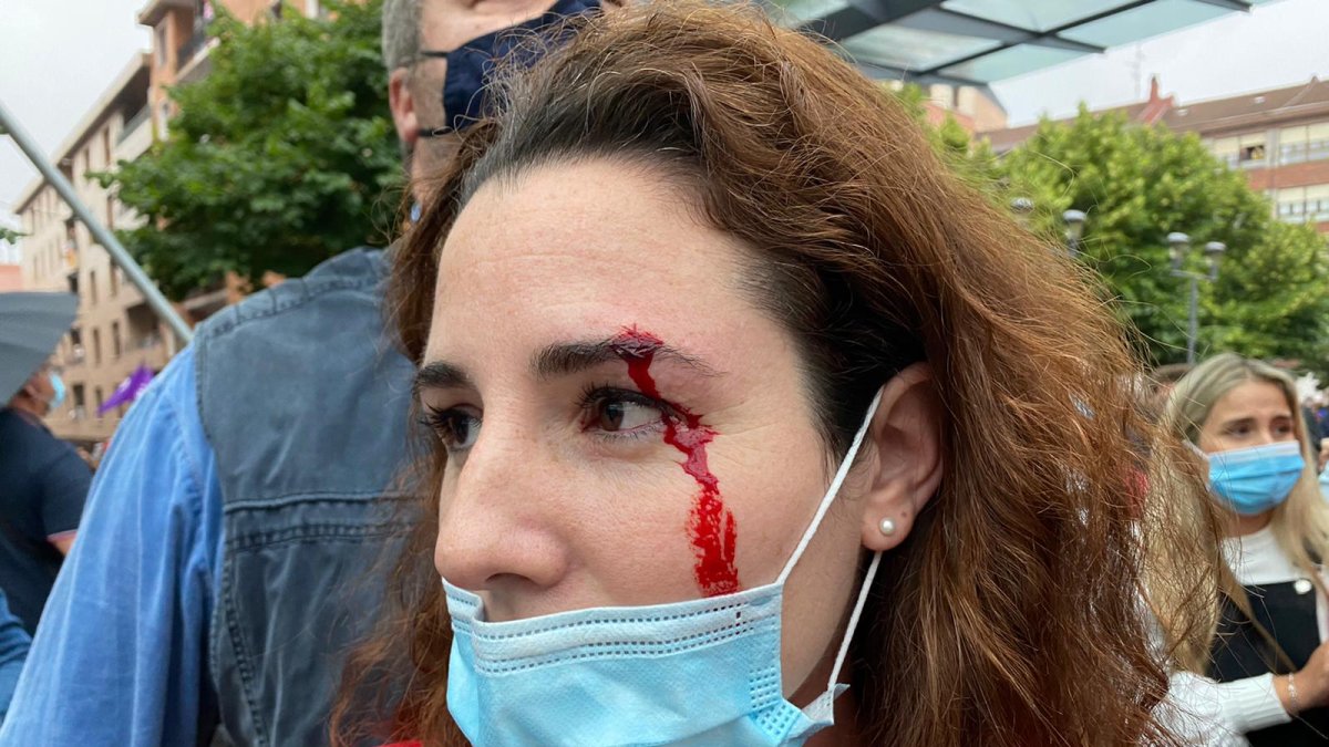 Rocío de Meer ha recibido una pedrada en Sestao.