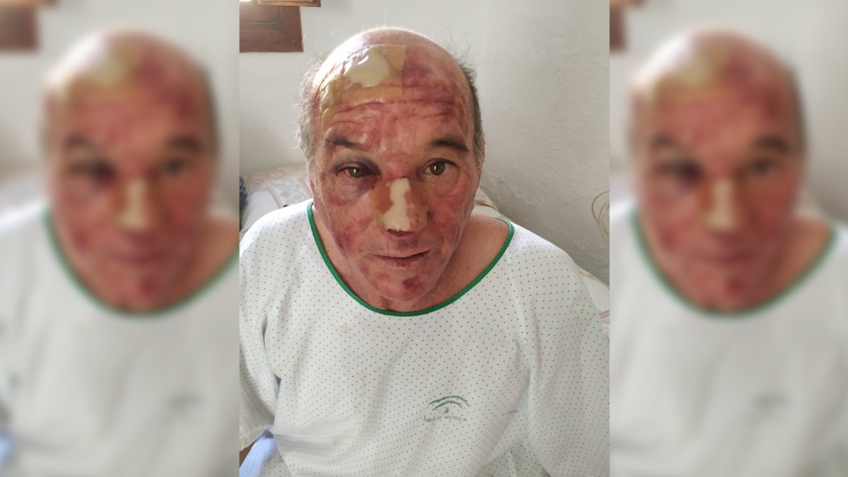 A. C. S., en el hospital de El Ejido, después de ser atendido tras el robo.