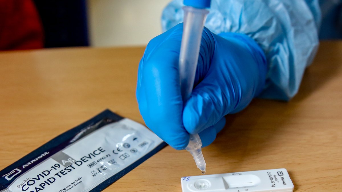 Material necesario para la realización de test de antígenos.