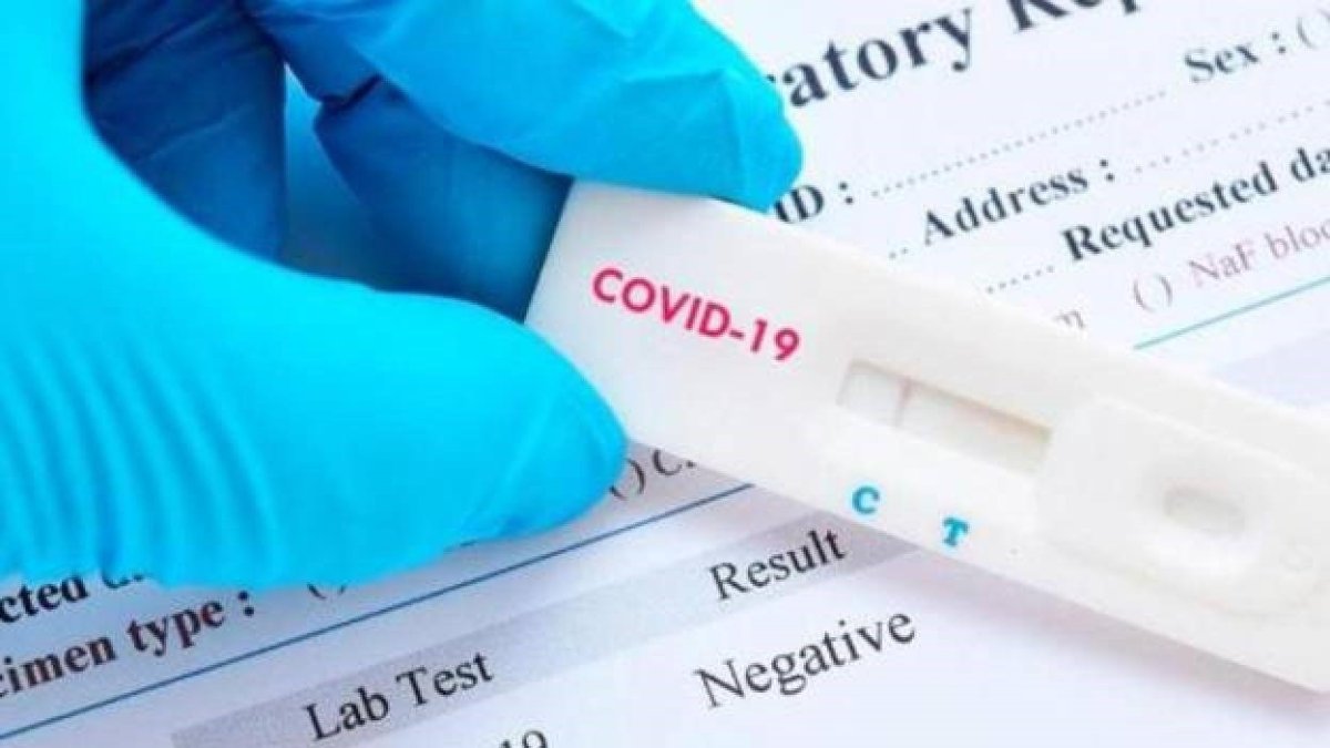 Test para la detección del Covid-19.