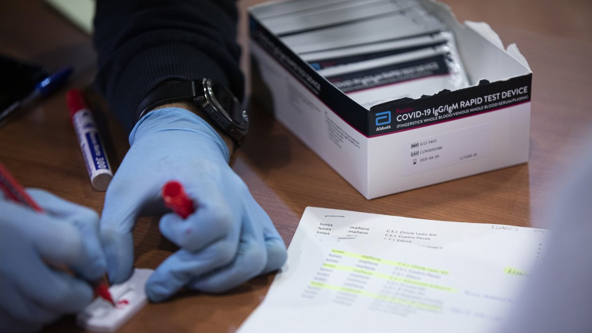 Test para la detección del coronavirus.