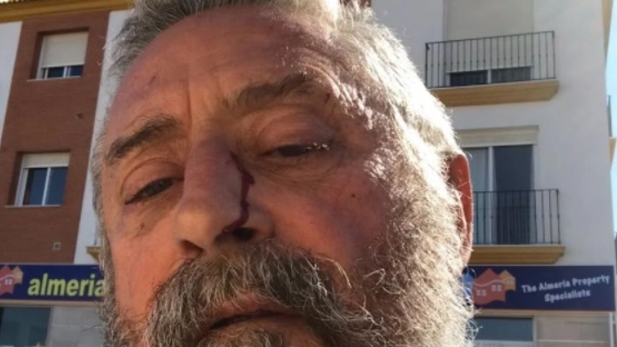 El alcalde mostrando la herida producida por el golpe que recibió.