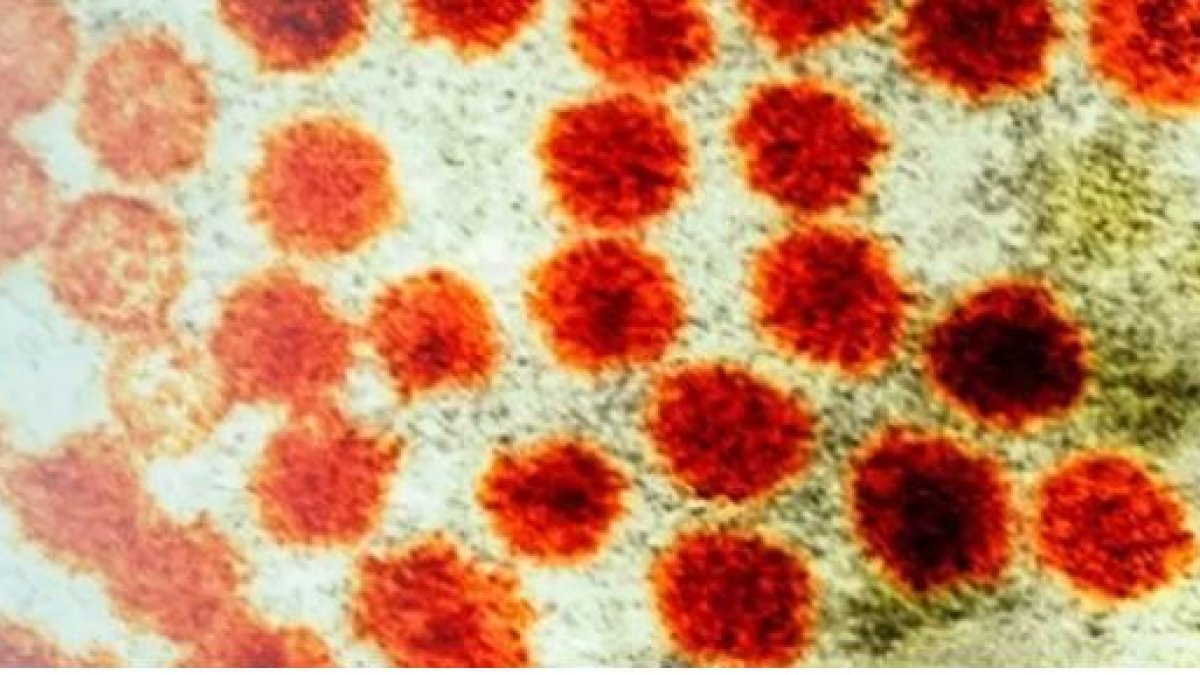 Hepatitis A: Foto: ECDC-Archivo