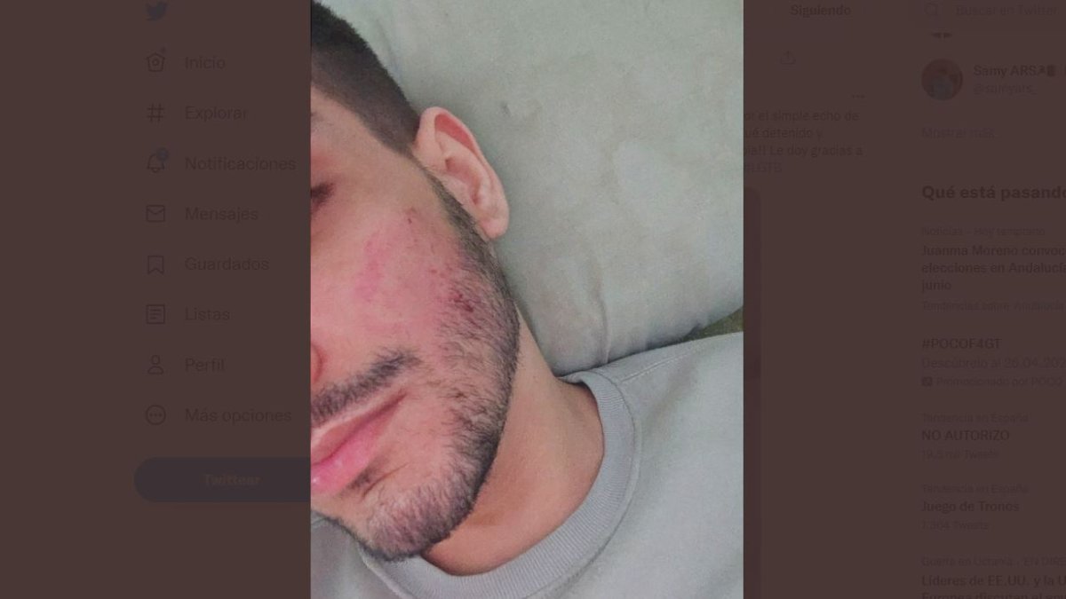 Una de las víctimas muestra las señales dejadas por su agresor.