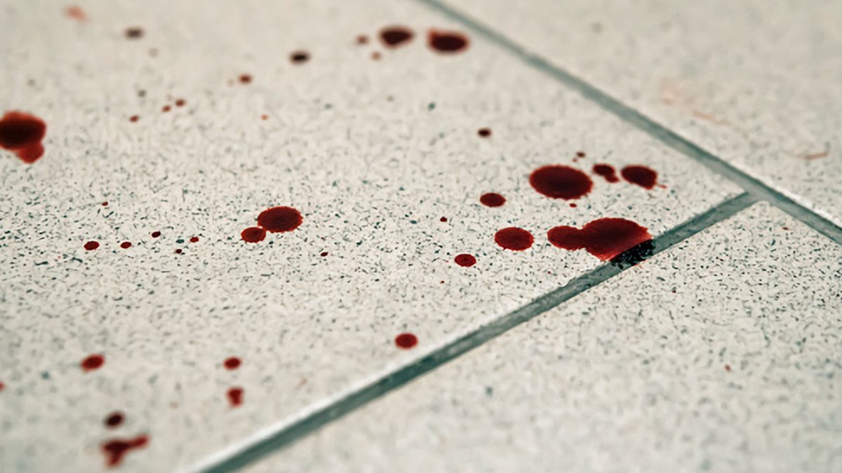 La víctima fue tiroteada por un desconocido.