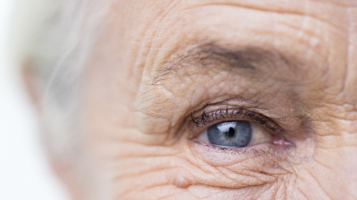 Envejecimiento de la piel