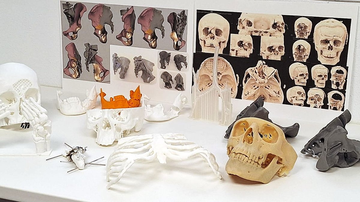 Modelos en 3D del Hospital Torrecárdenas.