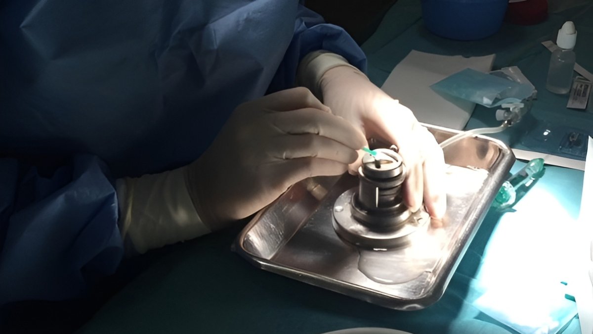 Imagen de donación de tejidos.