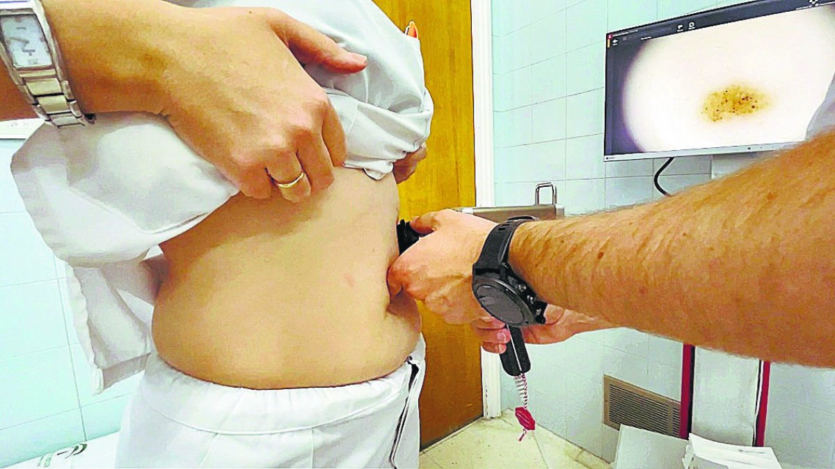 Consulta en la unidad de Dermatología.