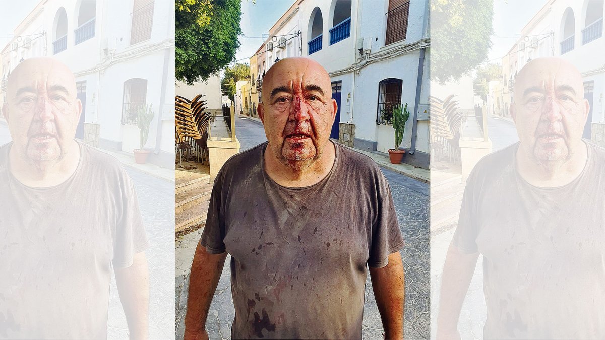 José Manuel Gil, muestra su rostro tras la agresión.