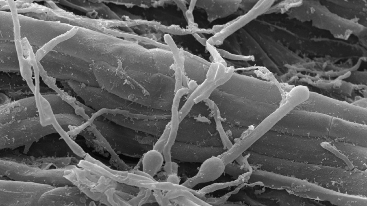 El pleno del Parlamento Europeo (PE) pidió este martes que sean más rápidos los procedimientos de aprobación y autorización de los agentes de control biológico