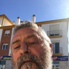 El alcalde muestra la herida que le ha producido el golpe.