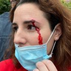 Imagen de Rocío de Meer tras el incidente en Sestao.