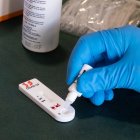 Mesa con pruebas de anticuerpos de detección de la Covid-19.