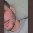 Una de las víctimas muestra las señales dejadas por su agresor.