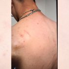 El joven presentaba lesiones en su espalda tras el suceso.