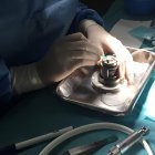 Imagen de donación de tejidos.