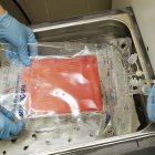 Donación de médula ósea.