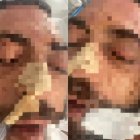 Dos de las imágenes del hostelero, compartidas por su hermano, mientras permanece en coma inducido.