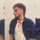 Imagen compartida por el joven tras la agresión.